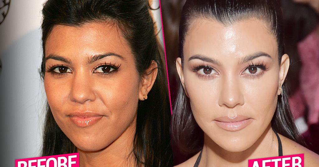 Kourtney Kardashian’s Massive Plastic Surgery Makeover Exposed By Top Docs