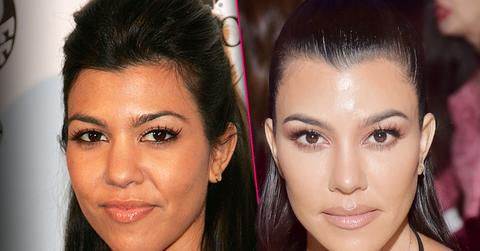 Kourtney Kardashian Plastic Surgery