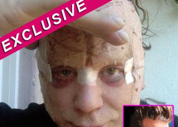 //pp_mickeyfacemessnow