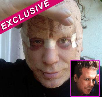 //pp_mickeyfacemessnow