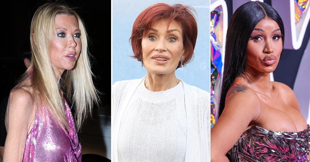 We Reveal Biggest Plastic Surgery Fails in Hollywood History