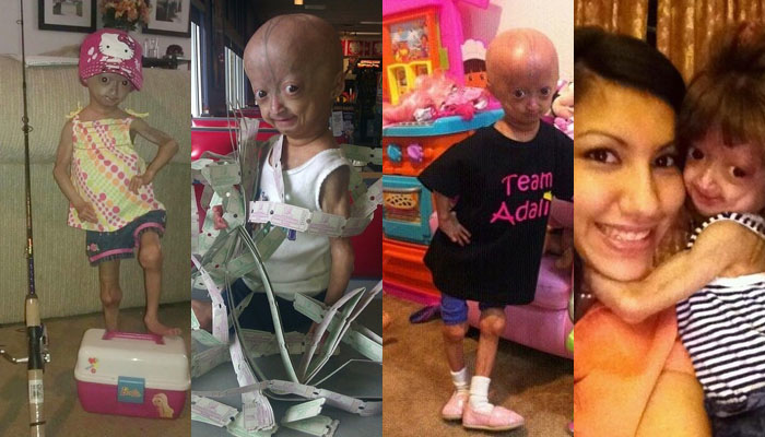 adalia rose mom