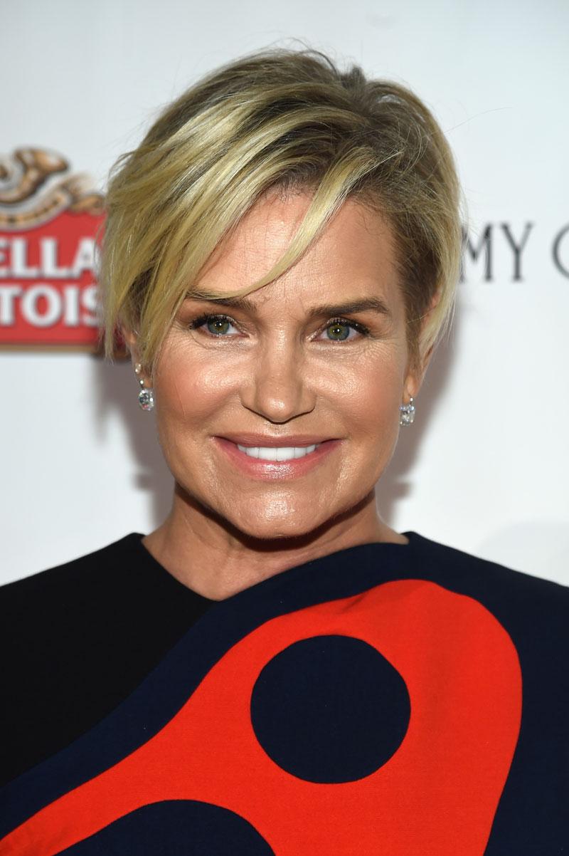 Yolanda Foster Plastic Surgery Botox Wrinkles