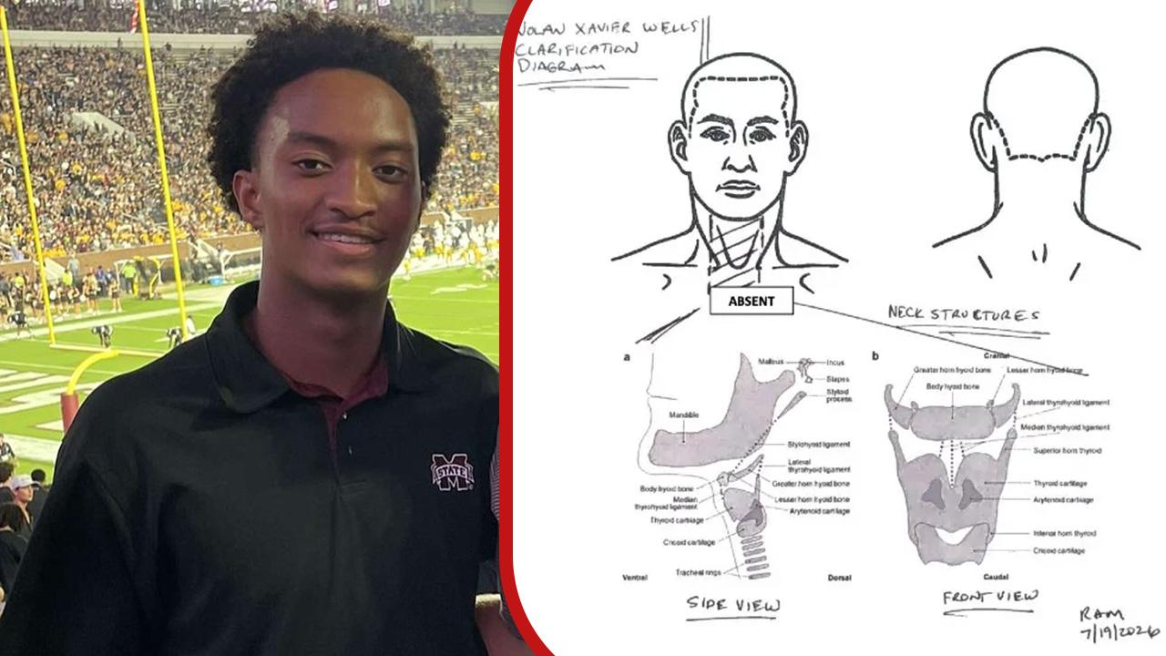 A doctor noted one finding on Nolan Wells' autopsy warranted 'further investigation.'