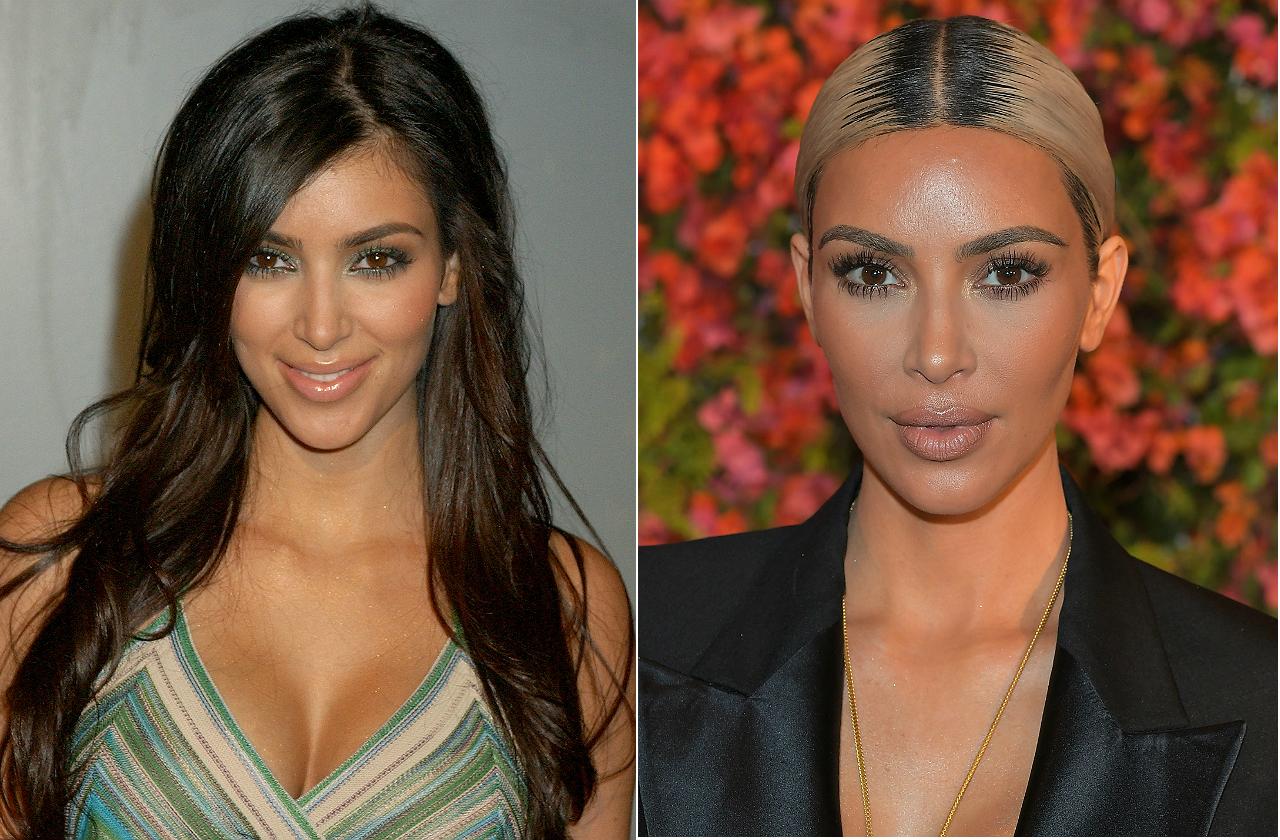 kim kardashian plastic surgery allure Image 9
