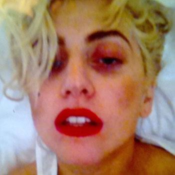 Lady Gaga 'In Discussions' to Testify as Witness in Rodney