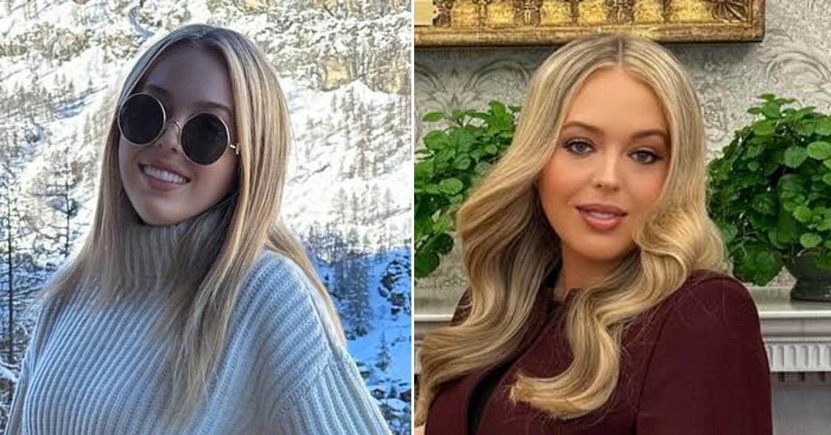 tiffany trump pregnant lip filler plastic surgery rumors experts