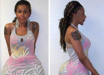 //oneal ron morris fake doctor injections