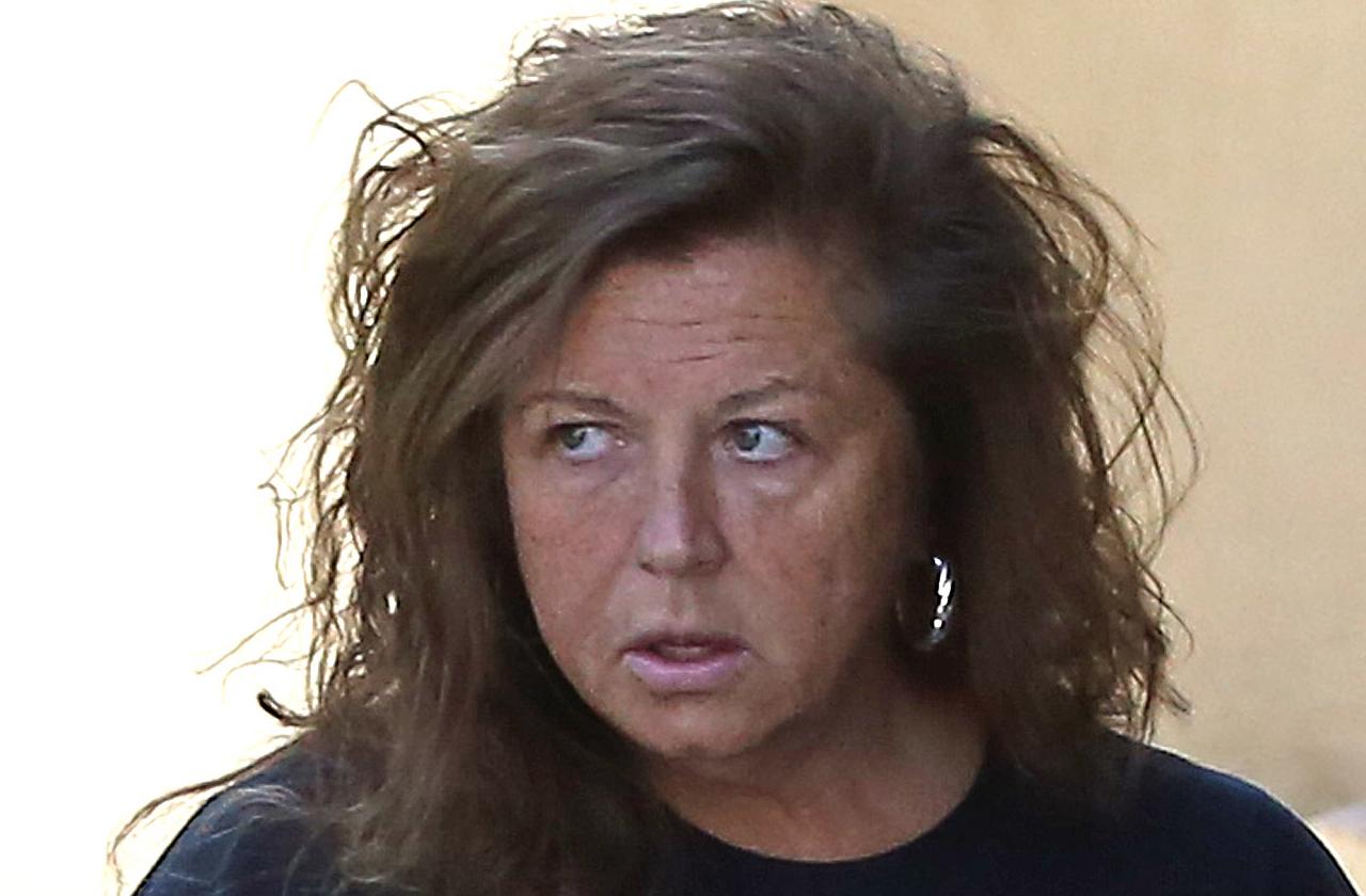 Abby Lee Miller Shows Off Scars, Removes Wig During Cancer: Pics