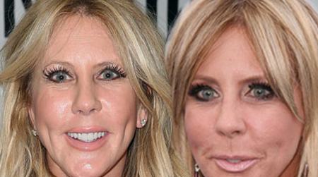 Vicki Gunvalson