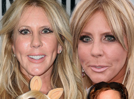 Vicki Gunvalson