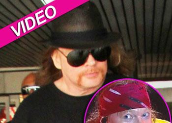 //axl rose weight gain pcn getty video