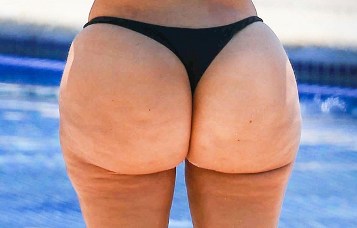 Cellulite nude