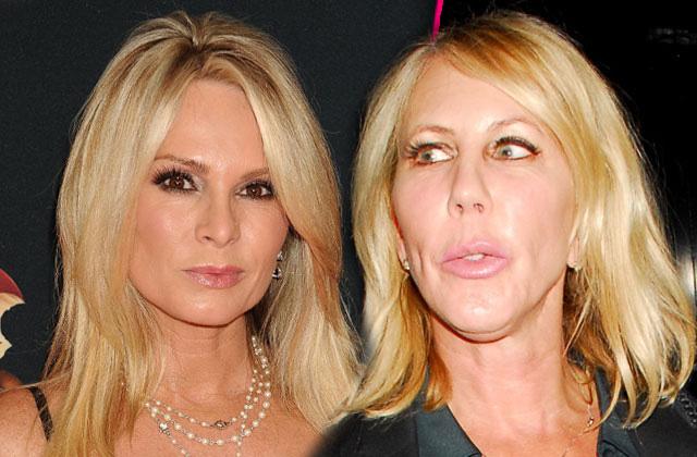 //tamra judge vicki gunvalson rhoc fight hurt attacks pp