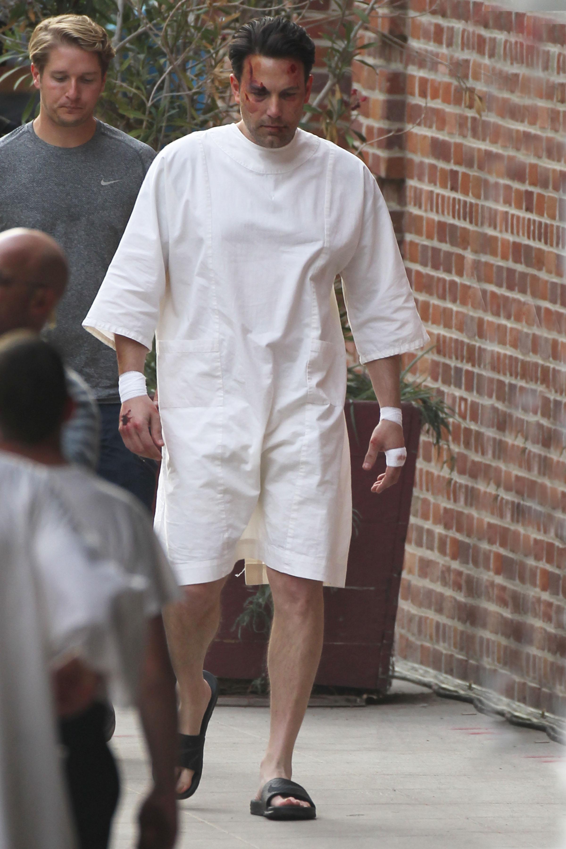 Ben Affleck Plastic Surgery Rumors Bloody On Set