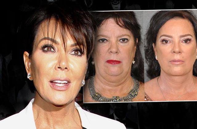 //kris jenner sister karen houghton plastic surgery facelift pics pp