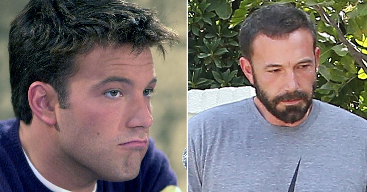 Ben Affleck Hairline Grabs Attention As Jennifer Lopez Romance