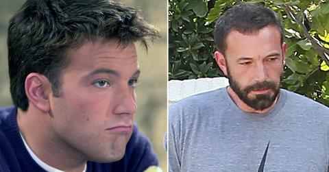 ben affleck hairline thinning jennifer lopez romance
