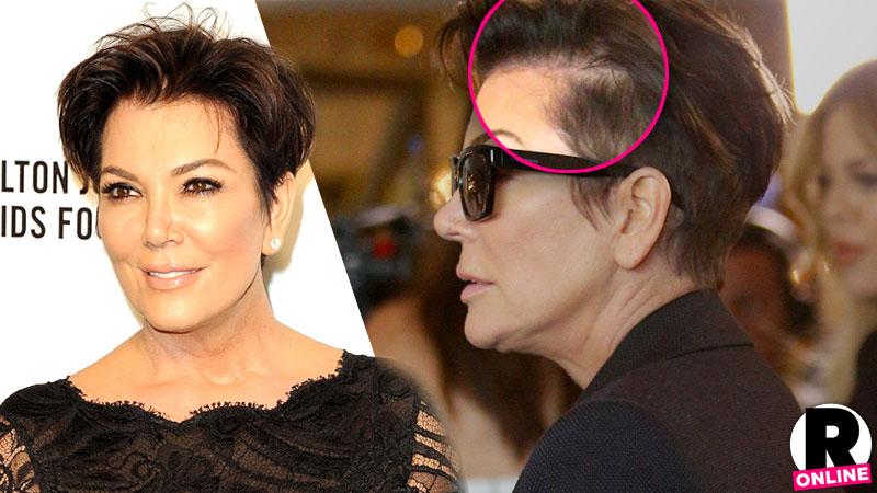 Kris Jenner Hair Loss