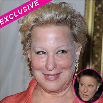 Frozen-Faced Bette Midler 'Has Overloaded On Botox' Says Plastic Surgeon