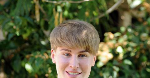 Toby Sheldon Has Plastic Surgery To Look Like Justin Bieber.