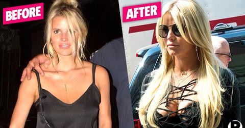 Breast Implants Doctor Weighs In On Jessica Simpson New Boobs