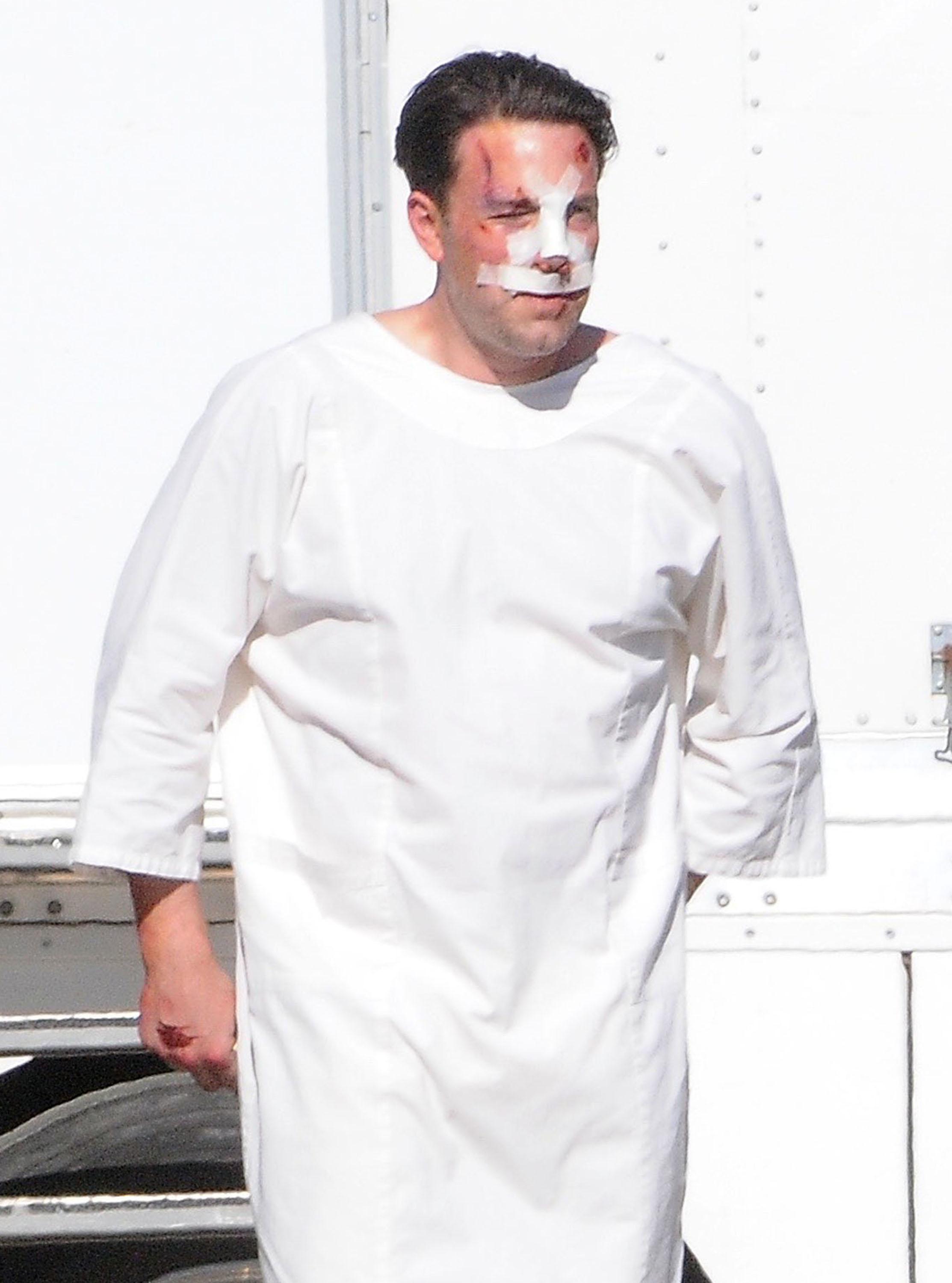 Ben Affleck Plastic Surgery Rumors Bloody On Set