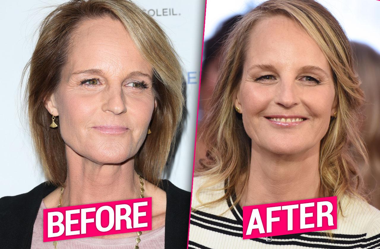 Helen hunt's lips