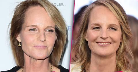 Helen Hunt Plastic Surgery