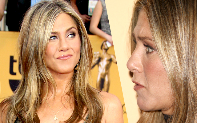 //Jennifer aniston plastic surgery pp