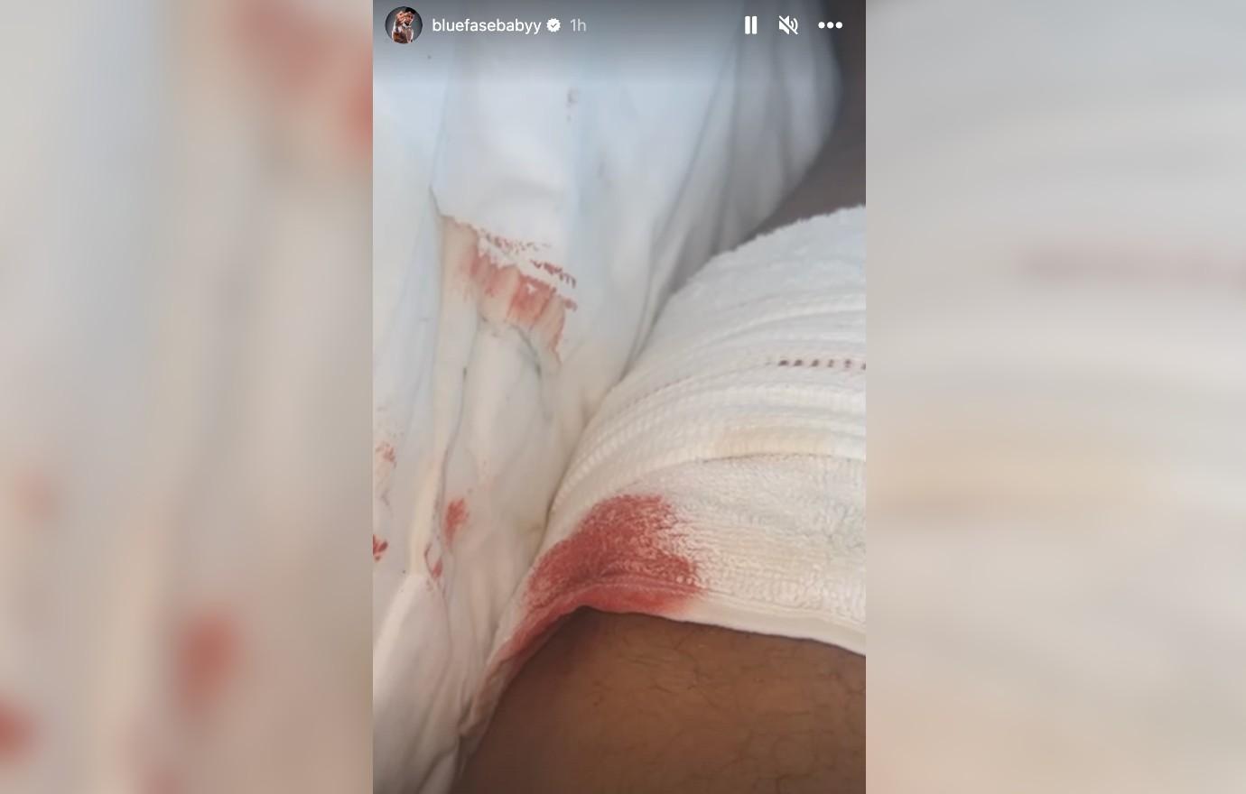 Watch the Video: Blueface Stabbed During Confrontation at Gym