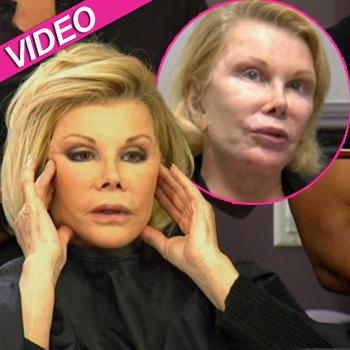 //joan rivers plastic surgery face wetv