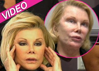 //joan rivers plastic surgery face wetv