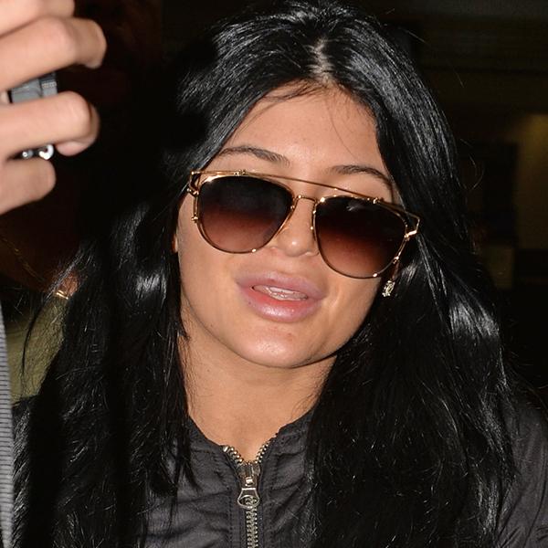 //Kylie Jenner Plastic Surgery