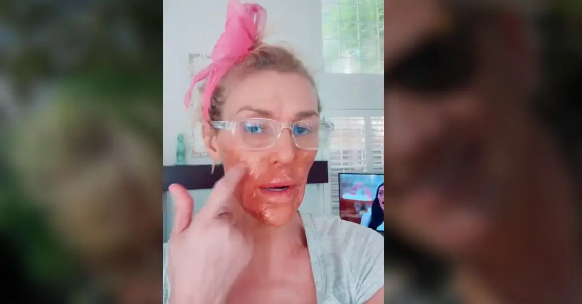 Brandi Glanville admitted she attempted to get rid of her apparent facial parasite with Nair.