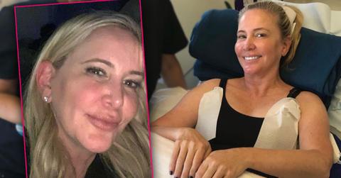Fished-Face Shannon Beador Gone Overboard Fillers Fat Freezing