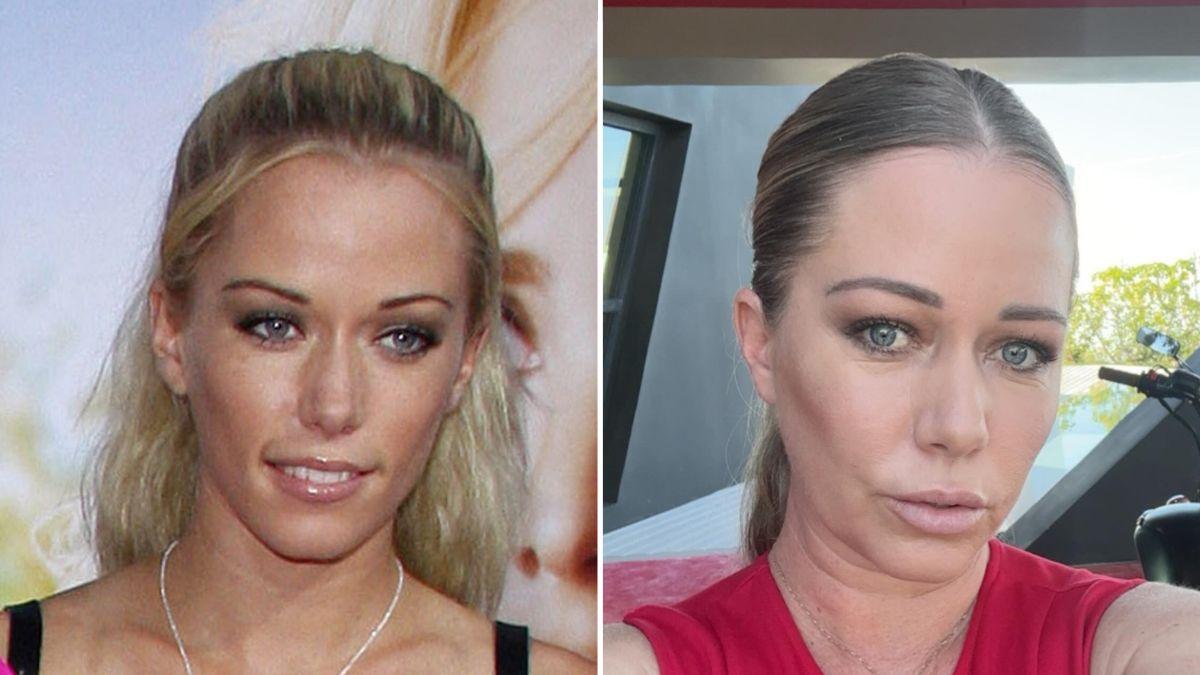 picture of Kendra Wilkinson