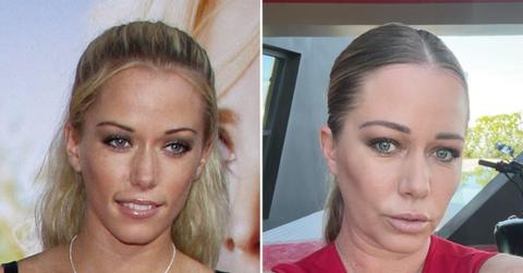 picture of Kendra Wilkinson
