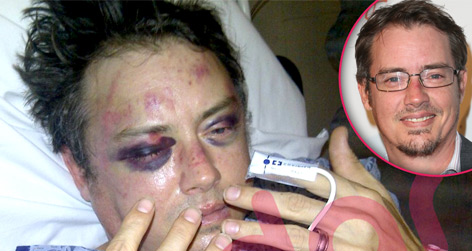 //jason london fight hands