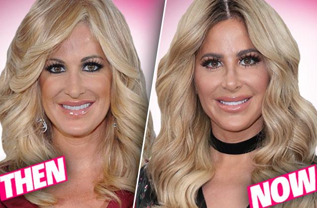 //kim zolciak denies plastic surgery nose job lip fillers wwhl pp