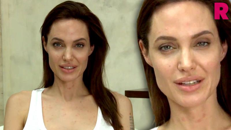 Angelina Jolie Cancels Upcoming ‘unbroken Commitments After Sony Email Hack Claims ‘chicken Pox