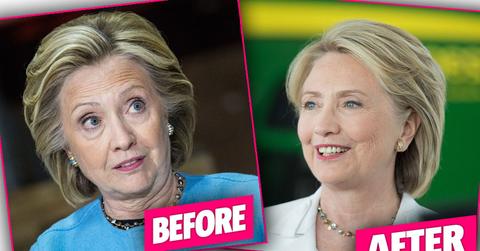 Hillary Clinton Facelift Tell All Book Edward Klein Claims
