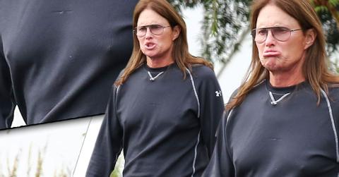 Bruce Jenner Transformation Puffy Lips