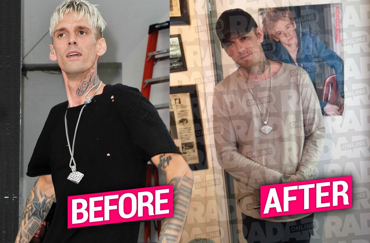 //Aaron Carter First Photo After Rehab pp