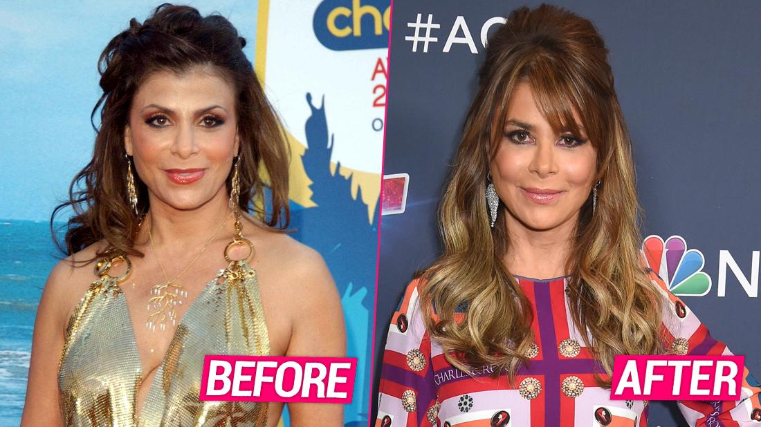 paula abdul admits plastic surgery pp