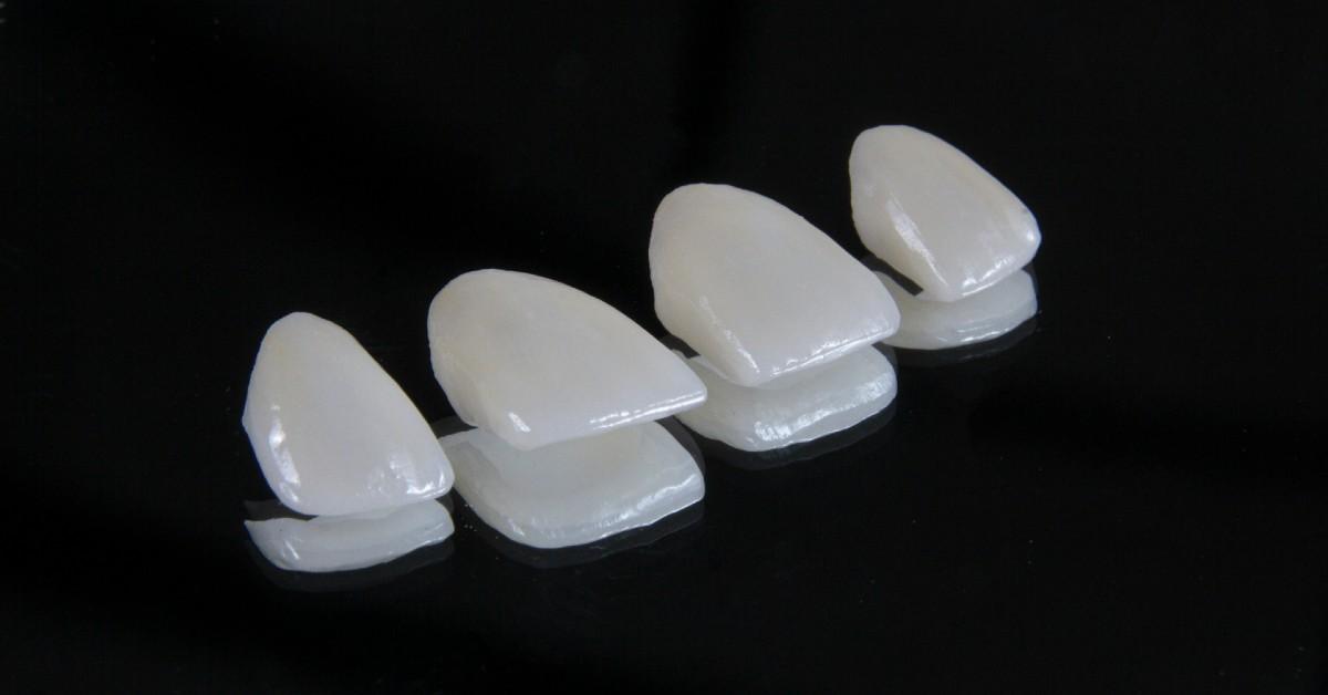One patient had to undergo 'emergency dental surgery to save her natural teeth.