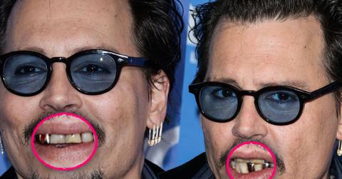 Johnny Depp Yellow Teeth Photos -- Drug Abuse Spiral?