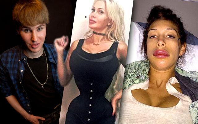 Most Outrageous Plastic Surgery 2015