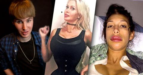 Most Outrageous Plastic Surgery 2015