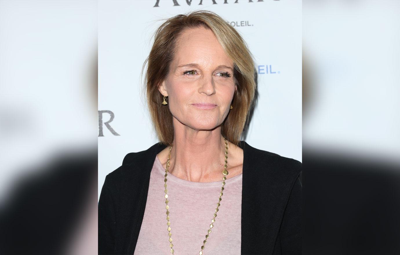 Helen Hunt Plastic Surgery